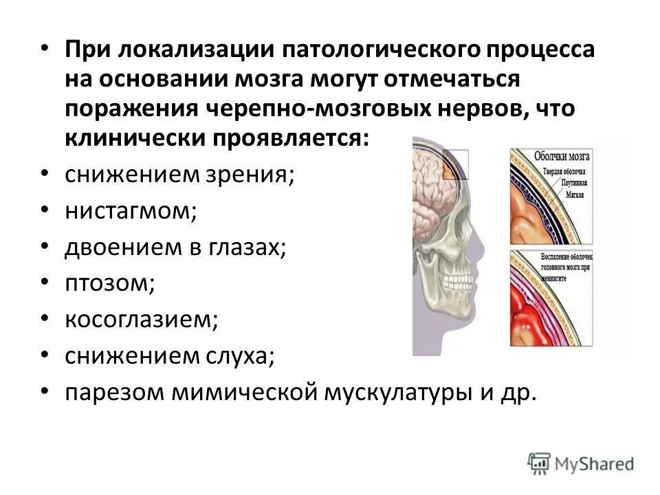 Воспаление оболочек головного и спинного мозга. Локализация патологического процесса. поражение черепных нервов при менингите. менингит-воспаление оболочек спинного мозга.