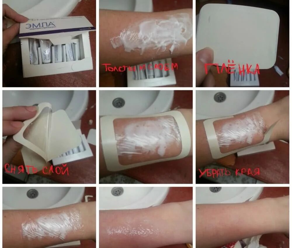 Обезболивающее для бикини. Обезболивающий крем для депиляции. Крем перед эпиляцией обезболивающий эмла. Эмла крем обезболивающий. Крем эмла для эпиляции бикини.