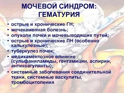 Гематурия критерии