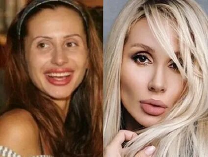 Жена после пластики