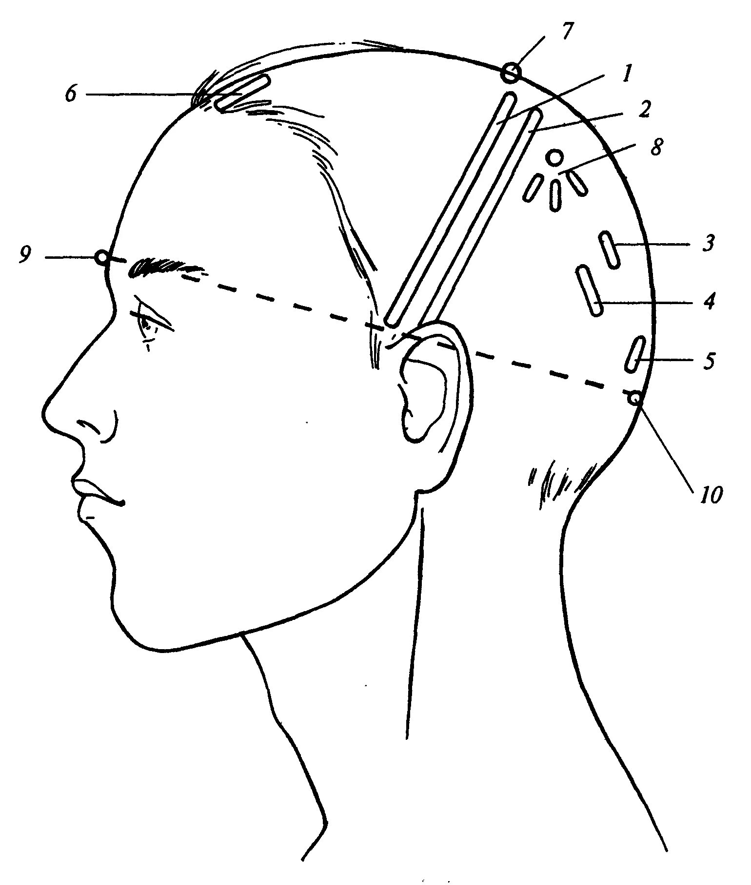 Затылок схема. Краниопунктура скальптерапия. Схема головы для парикмахеров. Зоны краниопунктуры. Части головы для парикмахеров.