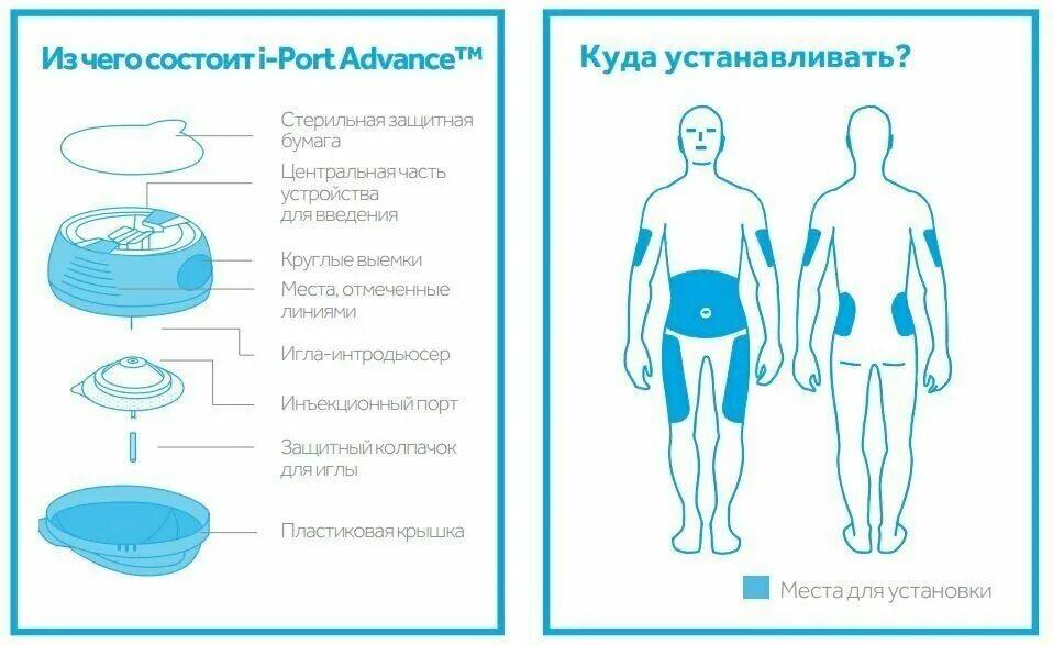 Устройство для введения инсулина. Инъекционный порт 10 шт Медтроник. Инъекционный порт IPORT Advance. Порты для введения инсулина. Инъекционный порт для введения инсулина.