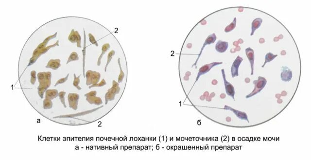 Форменные элементы осадка мочи