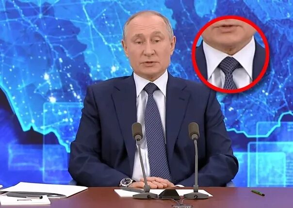 Болезнь Путина. Лицо Путина 2023.