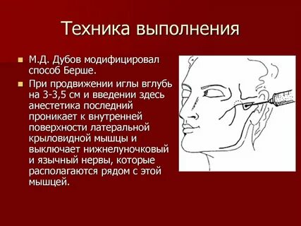 Блокада тройничного
