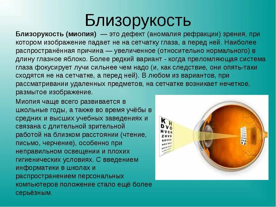 Близорукость. Близорукость миопия. Заболевание глаз миопия. Заболевание органов зрения миопия. Слабая миопия глаза что