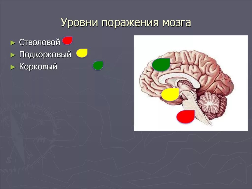 Подкорковые поражения мозга. Дефицитарность подкорковых структур мозга. Функциональная дефицитарность подкорковых образований мозга.. Функциональная дефицитарность подкорковых ядер мозга..