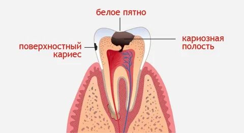 Нерв зуба где
