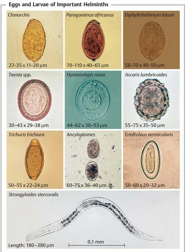 Diphyllobothrium latum яйца. Яйца гельминтов Diphyllobothrium latum. Яйца гельминтов микроскопия атлас. Яйца глистов микроскопия атлас. Купить яйца глист