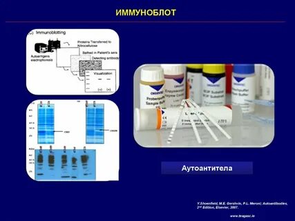 Иммуноблот