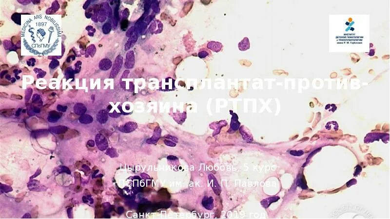 Трансплантант. . Реакция «трансплантат против хозяина». Фаза пролиферации;. Трансплантат против хозяина микропрепарат. . Реакция «трансплантат против хозяина».острая фаза ;. Трансплантация против хозяина.