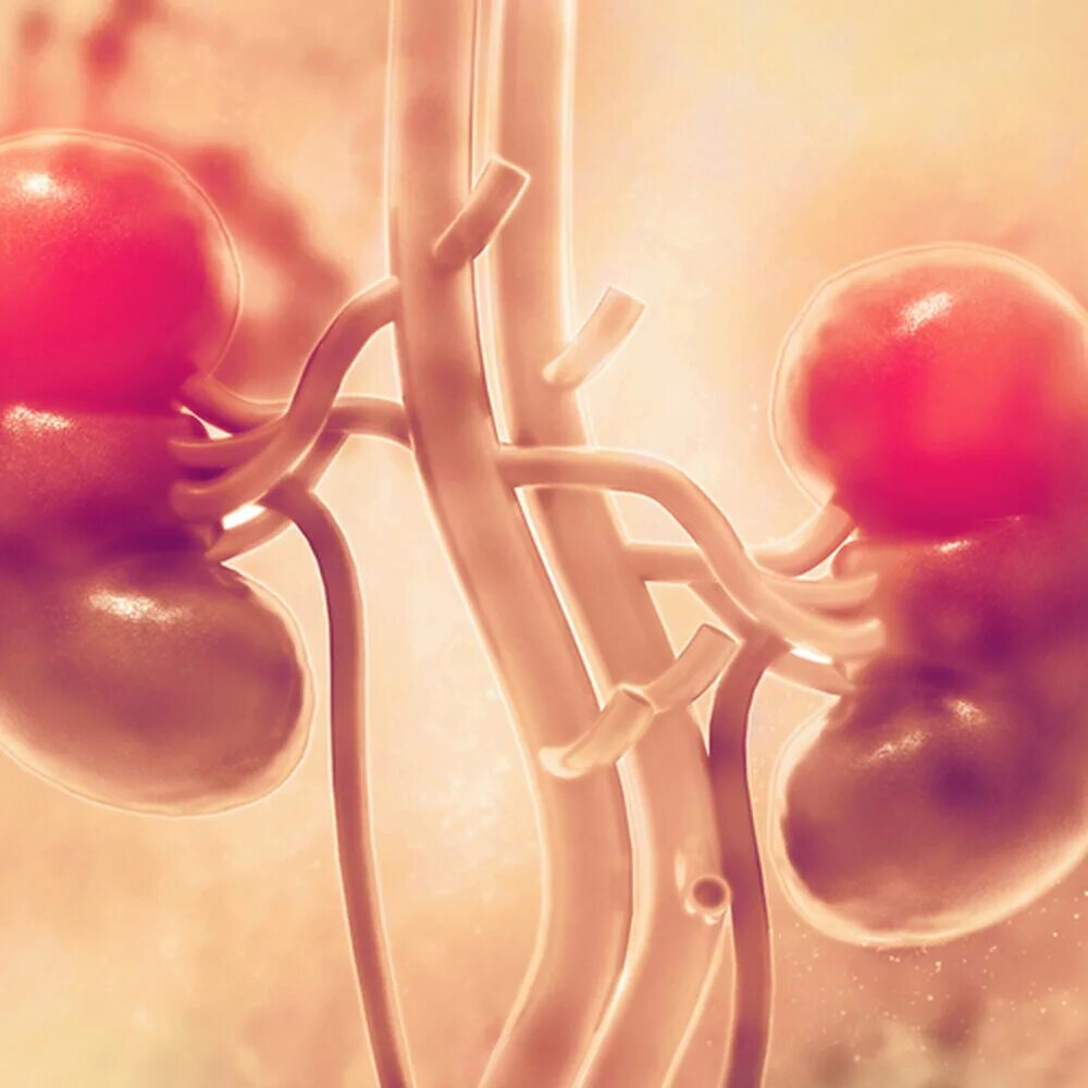 хронический гламированный нефрит. нефрит заболевание симптомы. нефрит врач. нефрит врач. мочекаменная болезнь и пиелонефрит.