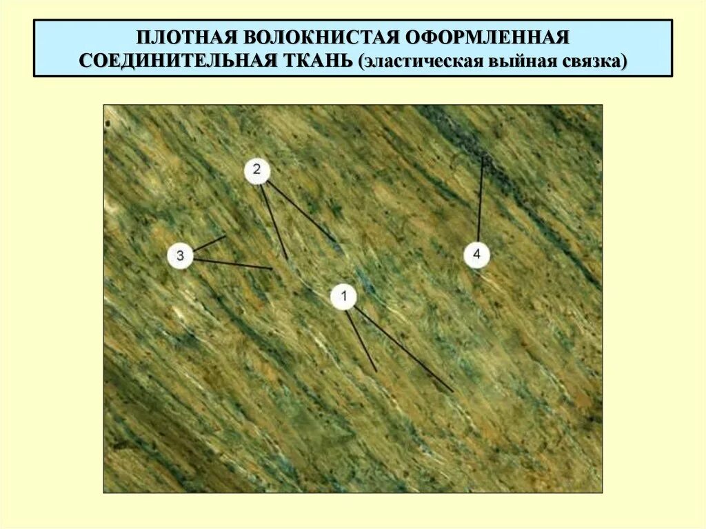 Плотная оформленная ткань. Эластическая ткань срез выйной связки. Плотная оформленная соединительная ткань эластическая связка. Эластическая соединительная ткань выйная связка. Плотная соединительная ткань связки гистология.