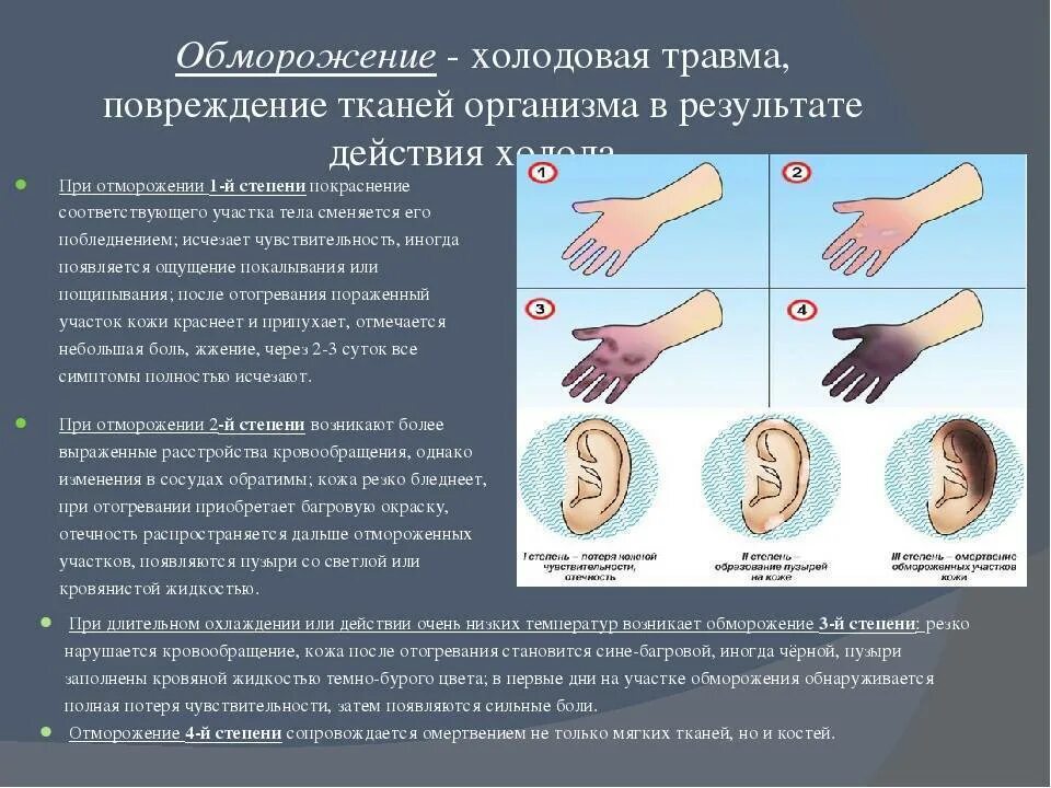 Обморожения 1,2,3 степени первая помощь. Первая помощь при ожогах и обморожениях биология 8. Первая помощь при обморожении 3 степени. Термические поражения .термические ожоги .холодовая травма. Заболевания и повреждения кожи