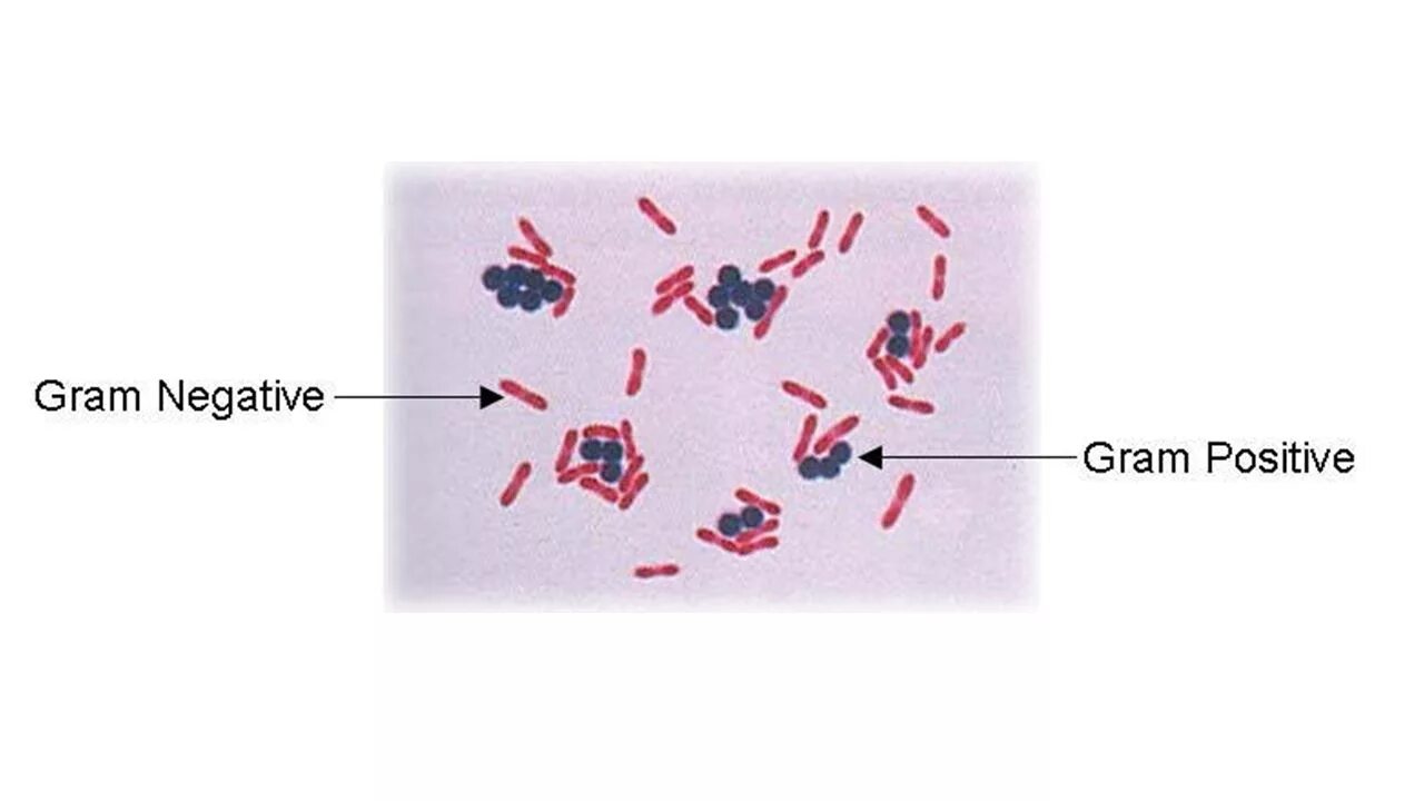 Бациллы в мазке. Окраска бактерий по Граму. Окраска Ожешко Bacillus anthracis. Грамотрицательные бактерии окраска по Граму. Смесь бактерий в окраске по Граму.