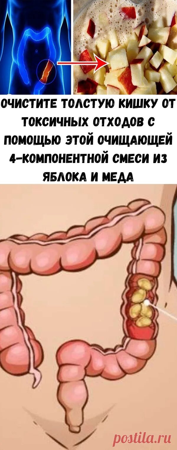 Кишечник очищается перед