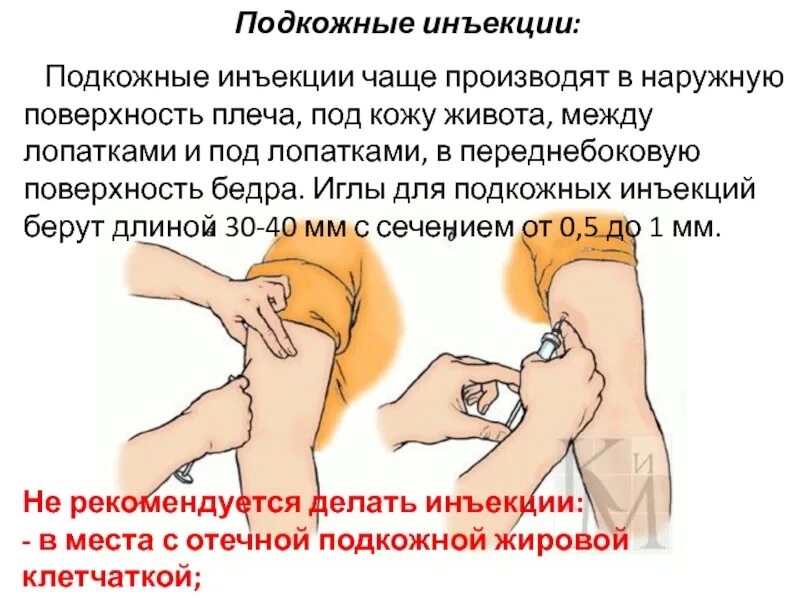 Алгоритм введения подкожной инъекции. Инъекция подкожно в плечо алгоритм. техника введения лекарственных средств внутримышечно подкожно. техника подкожной инъекции в плечо. алгоритм постановки подкожной инъекции в плечо.