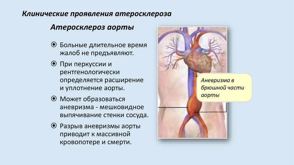 Что такое аортосклероз легких и как лечить