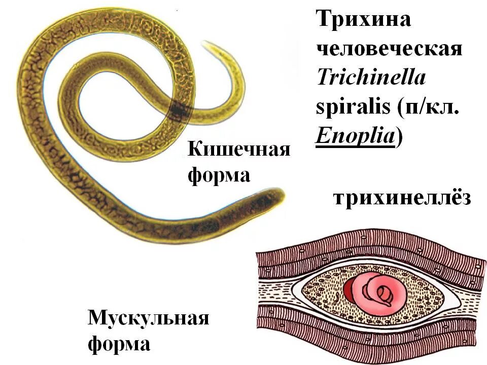 Круглые черви заболевания. Трихинелла взрослая особь. Круглые черви паразиты трихинеллы. Трихинелла круглые черви.