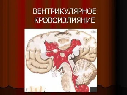 Кровоизлияние сосудов