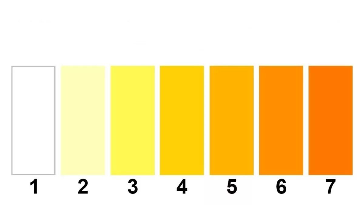 Цвет мочи. Ярко желтая моча. Моча соломенного цвета. Цвет мочи ярко желтого цвета. Здоровая моча какого цвета у женщин должна