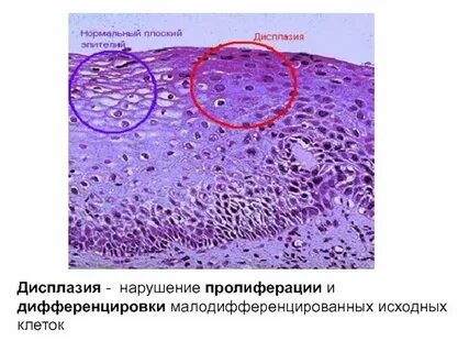 Нарушение пролиферации клеток