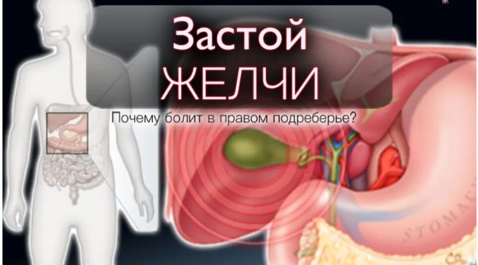 Застой желчного пузыря у взрослого симптомы