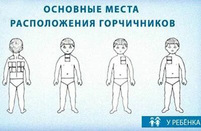 Как ставят горчичники при кашле взрослым фото