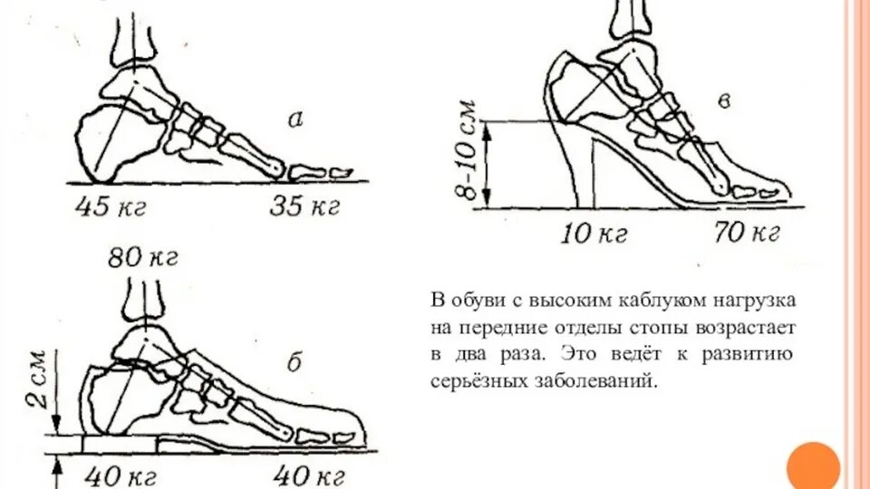 Распределение нагрузки на стопу. Стопа распределение веса. Как распределяется нагрузка на стопу. Нагрузка на стопу при ходьбе. Без чего невозможен полет с полезной нагрузкой