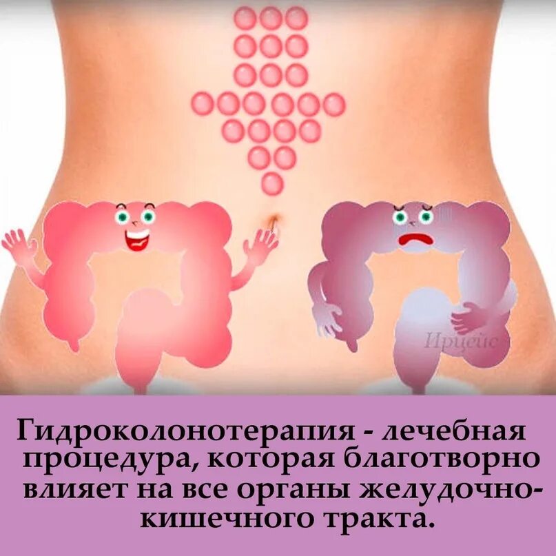 Чистка кишечника как называется процедура. Гидроколонотерапия кишечника. колоногидротерапия (гидроколонотерапия). гидроколонотерапия схема.