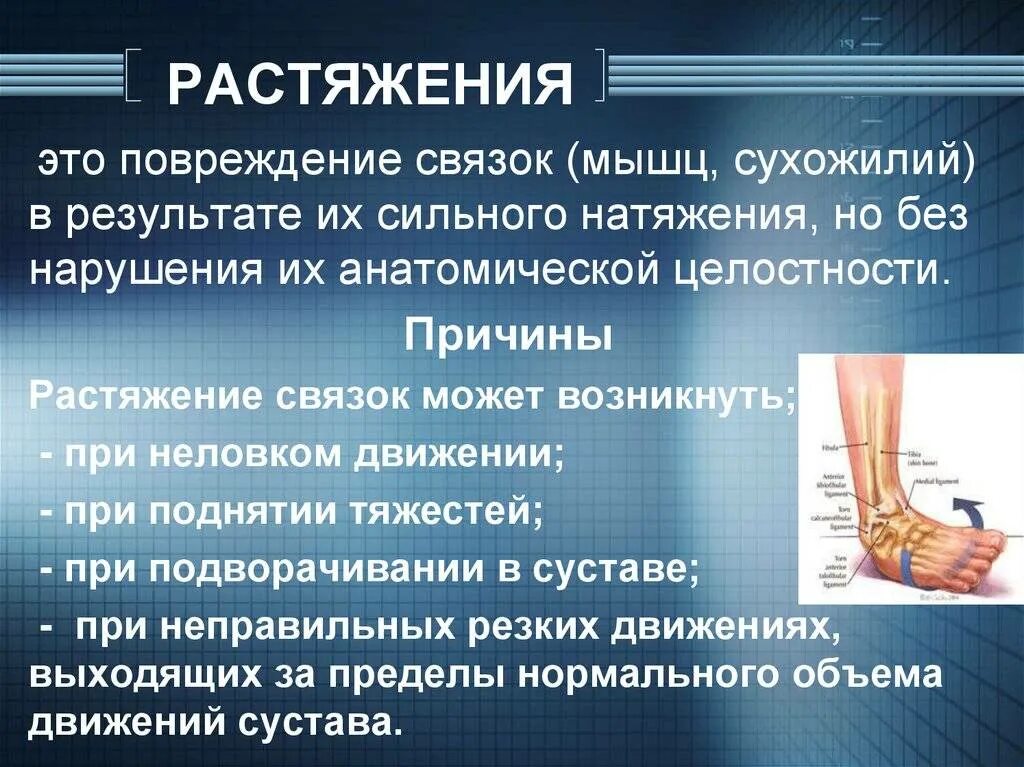 Растяжение связок сухожилий. Причины растяжения связок.