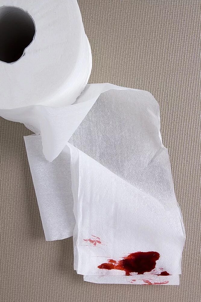 Кровь на туалетной бумаге. Кровь из носа на туалетной бумаге.