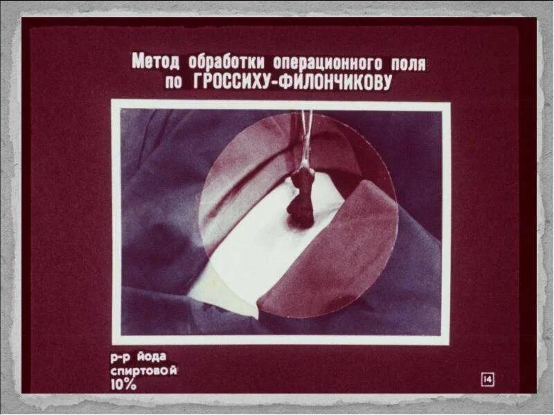 Алгоритм операционного поля. Методы обработки операционного поля. Обработка операционного поля по Филончикову. Обработка операционного поля по методу Гроссиха-Филончикова. Методика обработки операционного поля по Гроссиху – Филончикову.