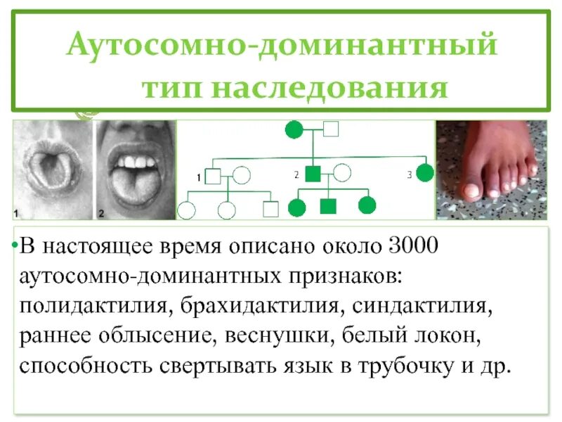 Доминантные наследственные признаки. Ауто доминантный Тип наследования. Облысение Тип наследования аутосомно-доминантный. Тип наследования брахидактилии. Признаки по аутосомно доминантному.