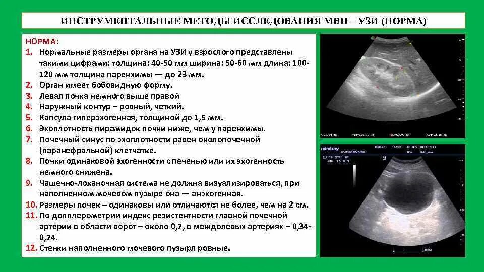 Толщина почечной паренхимы в норме по УЗИ. Размеры чашечно лоханочной системы почек в норме. УЗИ печени нормальные показатели у детей. Расшифровка УЗИ почек норма у женщин. Показатели узи печени