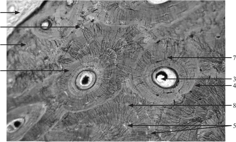 Пластинчатая кость в поперечном разрезе. Пластинчатая костная ткань. Плотная пластинчатая кость в поперечном разрезе. Общая и частная гистология. Остеон 2
