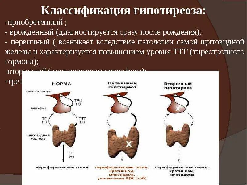 Типы гипотиреоза. Врожденный первичный гипотиреоз. Гипотиреоз классификация. Классификация гипотеоиоза. Классификация гипотериоща.