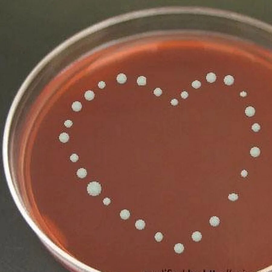 Шоколадный агар. Haemophilus influenzae на шоколадном агаре. шоколадный агар в микробиологии. шоколадный агар (h. influenza. среда шоколадный агар.