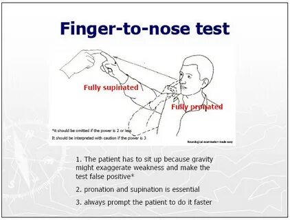Short fingered