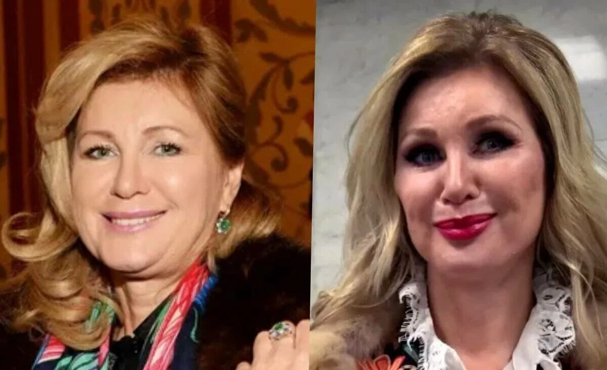 Вика цыганова до пластики. Вика пластика. Вика пластика. Вика пластика. Вика пластика.