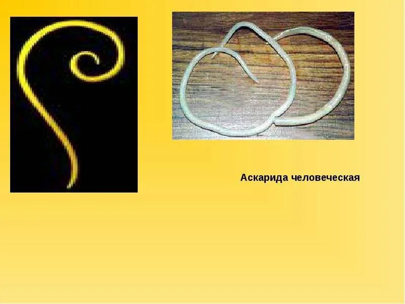 Тип взаимоотношений между аскарида и человек. Аскарида человеческая размер.