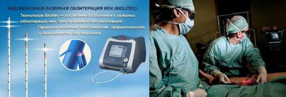 Биолитек аппарат для ЭВЛК. Варикозное расширение вен. Лечение варикоза лазером фото до и после. ЭВЛК лазер России и Америки.