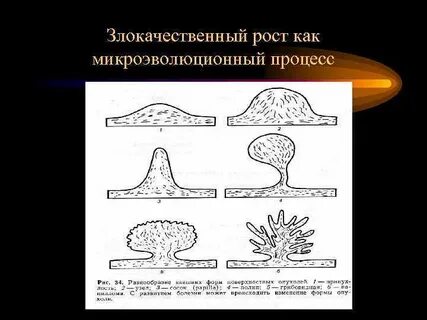 Злокачественный рост