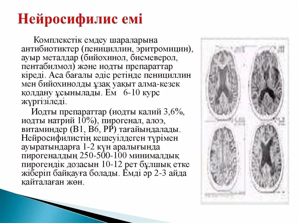 Лечение нейросифилиса. Нейросифилис патологическая анатомия. Нейросифилис этиология. Нейросифилис клинические проявления.