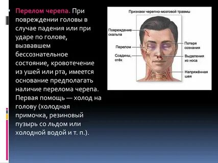 Помощь при переломе черепа