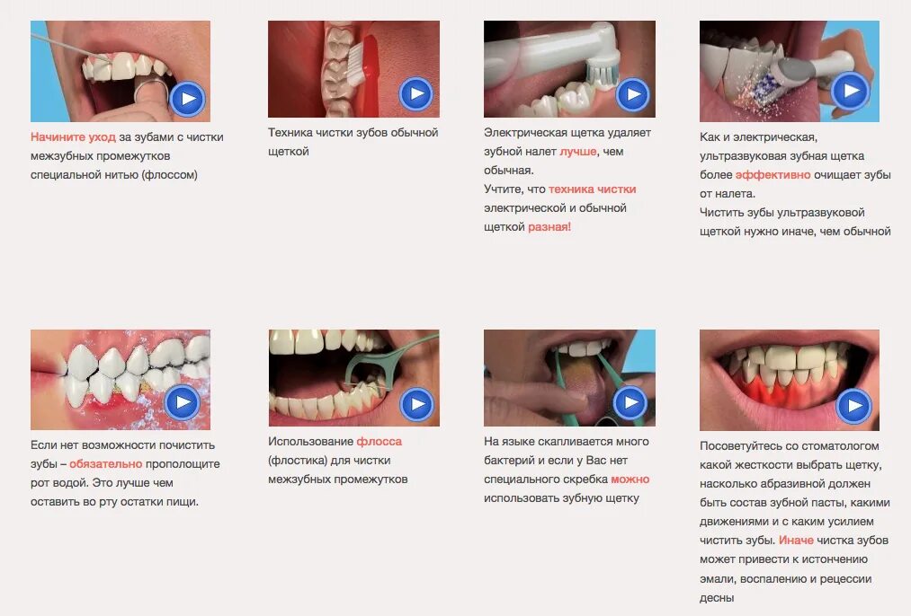 Что кушать после чистки зубов. Электрическая зубная щётка схема чистки. Как правильно чистить зубы электрической щеткой. Схема чистки зубов электрической зубной щеткой. Электрическая щетка для межзубных промежутков.