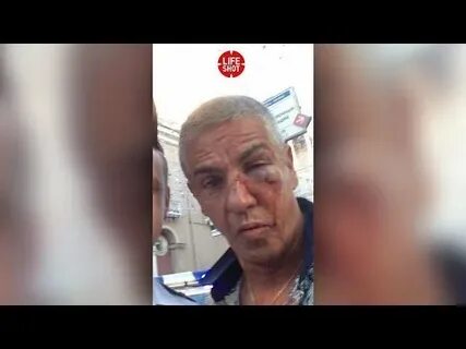 Сами насери избили