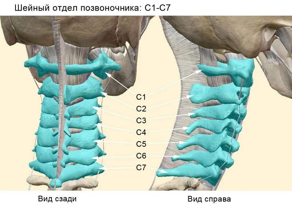 Протрузии дисков с3 с7
