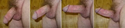 Circumcised Human Penis.JPG. 