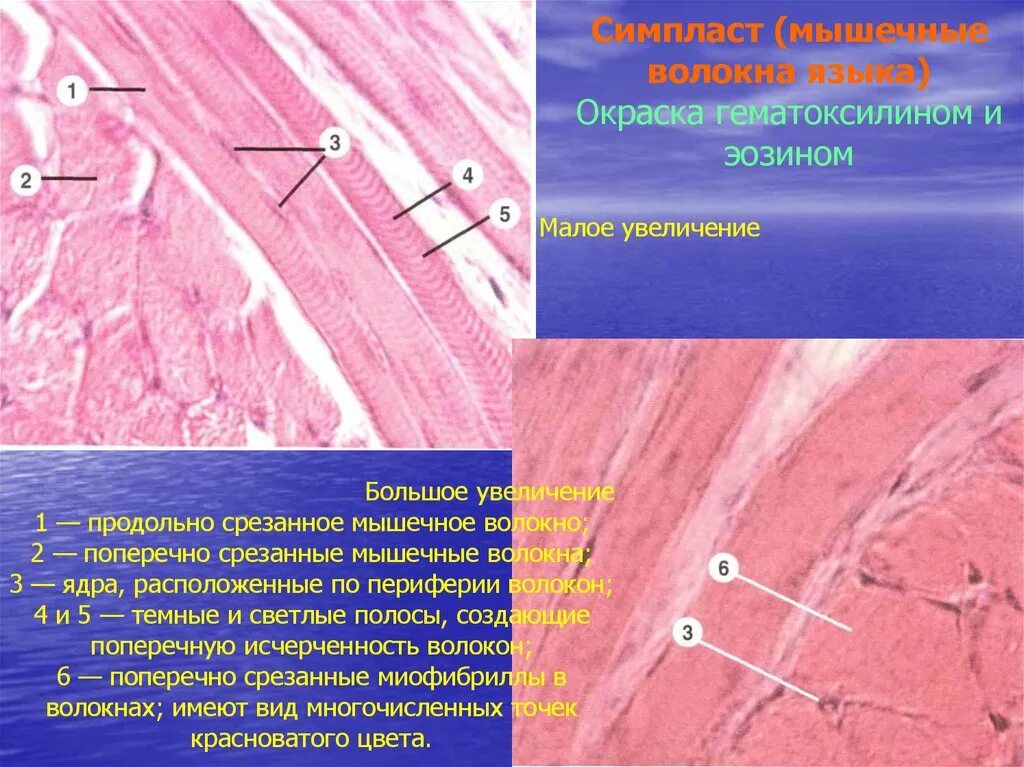 Увеличение больших половых. Строение симпласта гистология. Мышечное волокно Симпласт гистология. Исчерченная мышечная ткань языка гематоксилин эозин. Симпласт поперечно-полосатое мышечное.